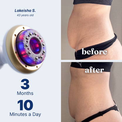 SculptFlow | Firmer, More Toned Skin