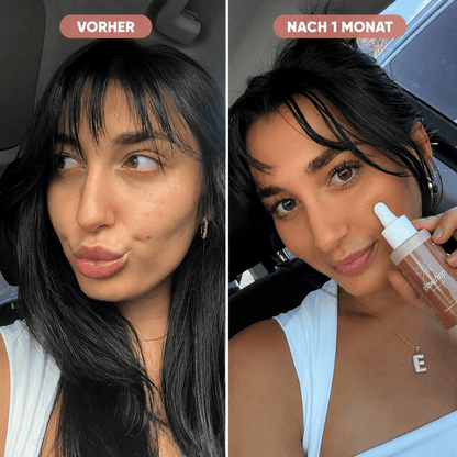 GlowDrop™ – The Glow You Drink