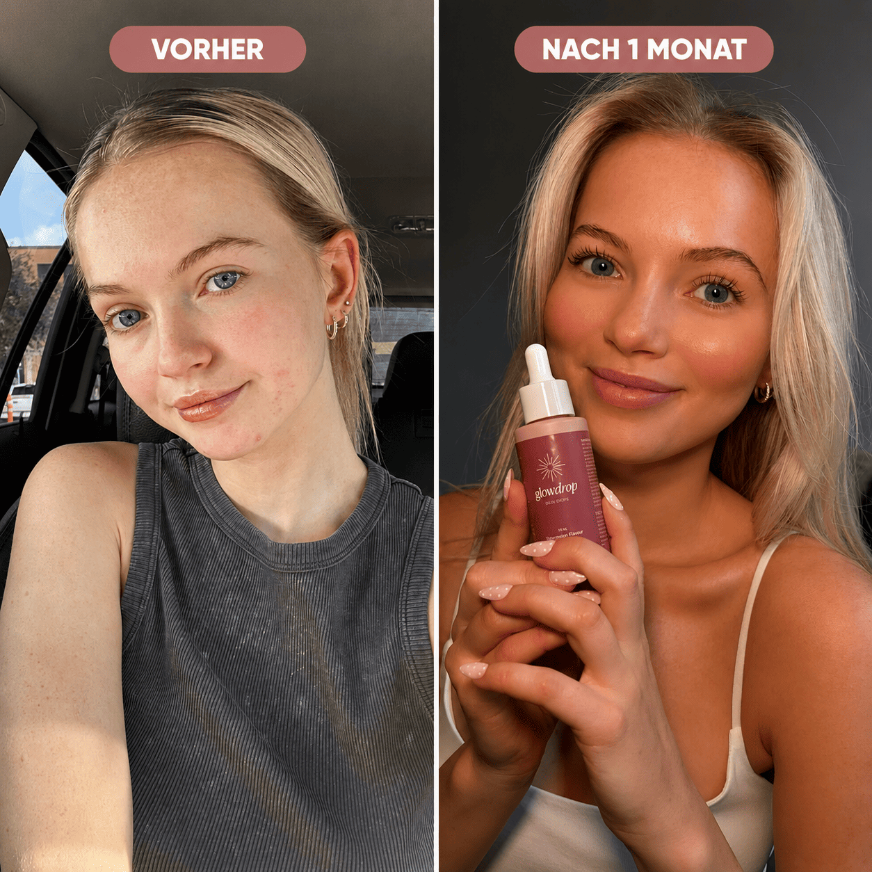 GlowDrop™ – The Glow You Drink