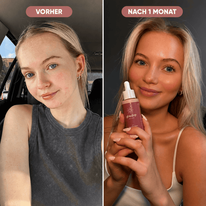 GlowDrop™ – The Glow You Drink